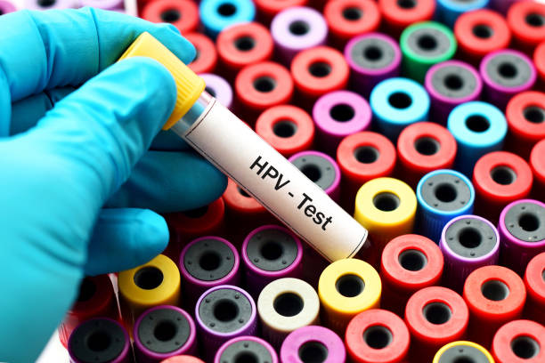 Human papilloma virus screening 