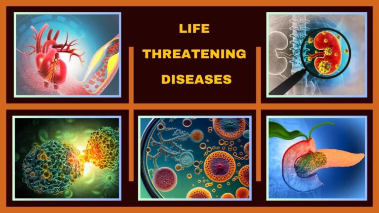 Life Threatening Diseases